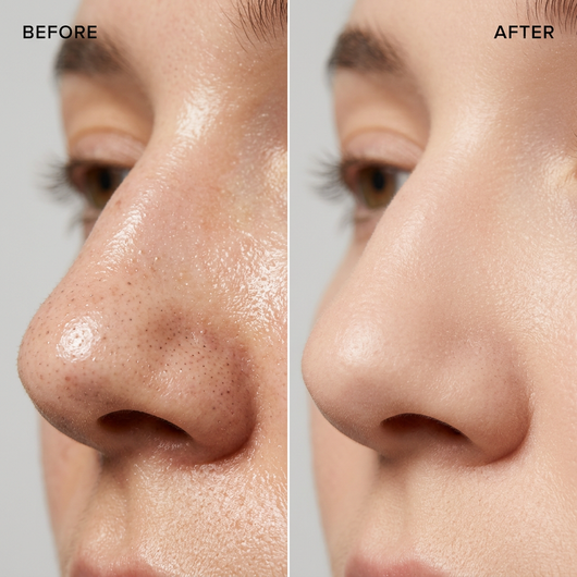 Pore clay stick